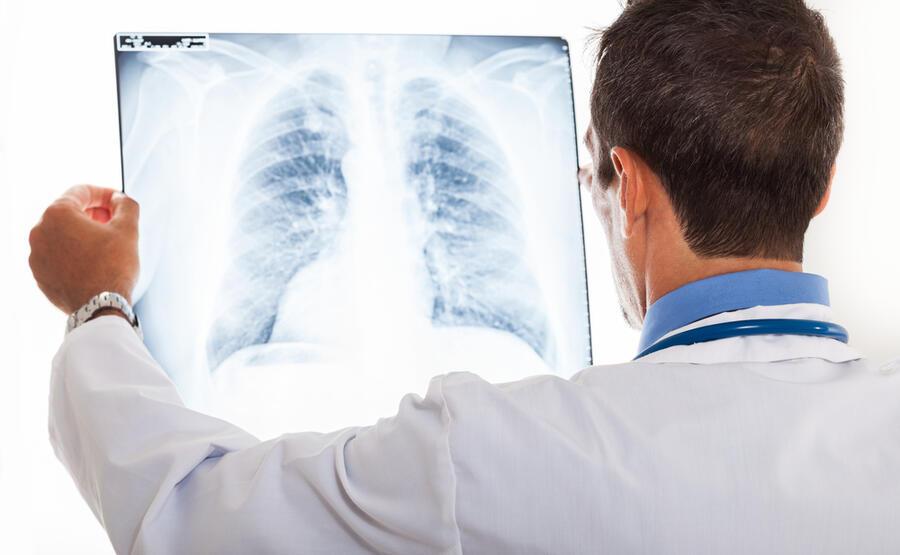 Akciğer embolisi nedir? Tedavisi nasıl olur?