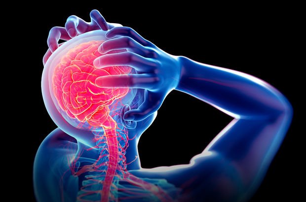 Beyincik sarkması nedir? Beyincik sarkmasının belirtileri ve tedavisi